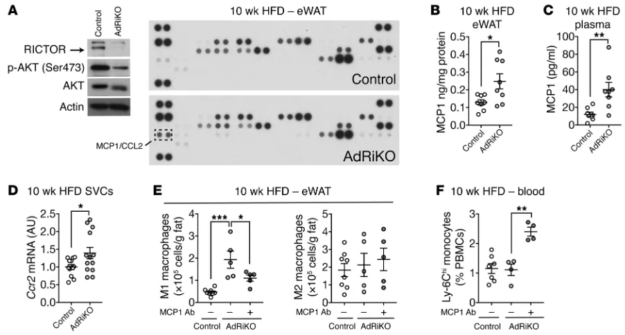 Figure 4. Insulin/mTORC2 signaling inhibits Mcp1(CD45 transcription and M1 macrophage accumulation in vivo