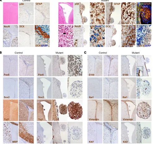 Figure 1. Targeted inactivation of Tsc1 and Pten in early-postnatal SVZ NSCs promotes the development of SVZ aberrant structures, reminiscent of SENs