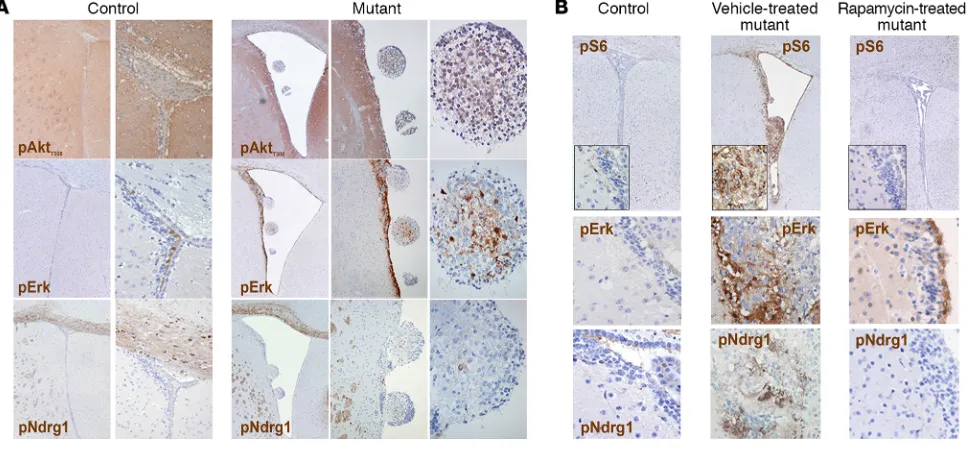 Figure 2. The periventricular abnormalities developing in P10 TPN(original magnification, ×40, ×100, and ×400; controls, ×40 and ×200 for pAkt and pErk; ×40 and ×100 for pNdrg1)