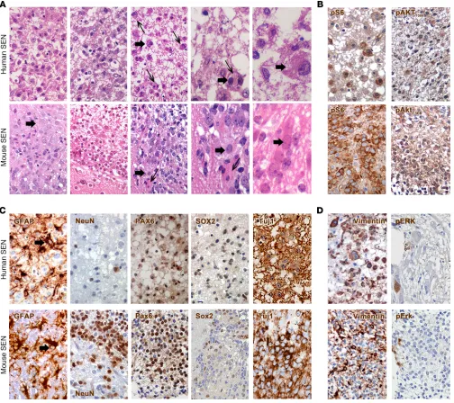 Figure 3. Mouse SENs closely mimic the corresponding human manifestation. (A) The morphology of human (n = 3) and mouse SENs (n = 3) was characterized by the presence of a gliofibrillary mesh that contained a majority of small cells and only rare giant cel