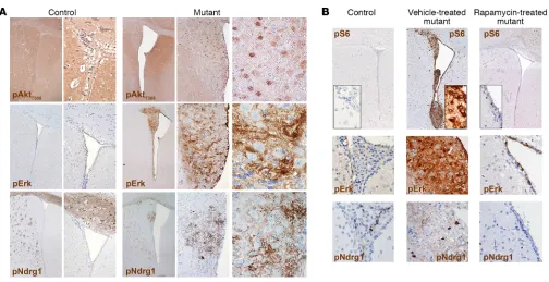 Figure 5. The periventricular abnormalities developing in P15–17 TPN×200; pErk and pNdrg1, ×40 and ×100)