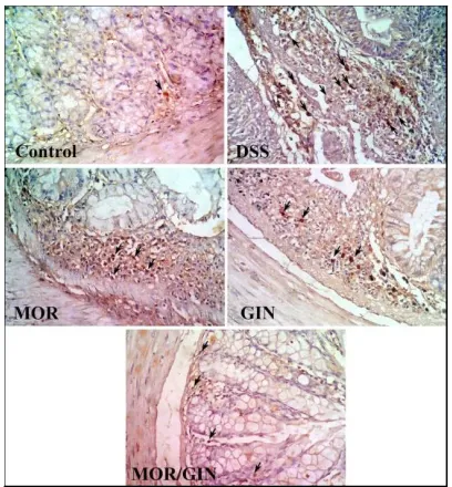 Fig. 2. Immunohistochemical staining with  MOR produced mild to moderate reduction of NFKcytoplasm of inflammatory cells infiltrate of NFKβ showed markedly expressed in the DSS-treated group