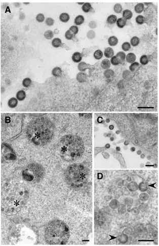 FIG. 5. EM analysis of NL4-3(�Numerous budding structures are seen at the cell surface