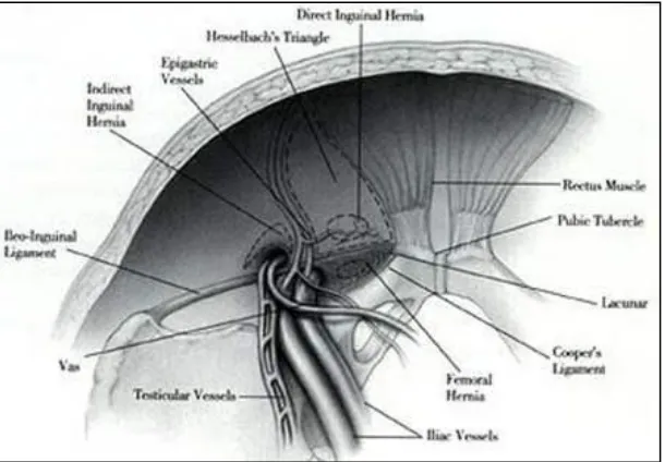 FIG-04.VIEW OF INGUINAL AND FEMORAL HERNIAS 