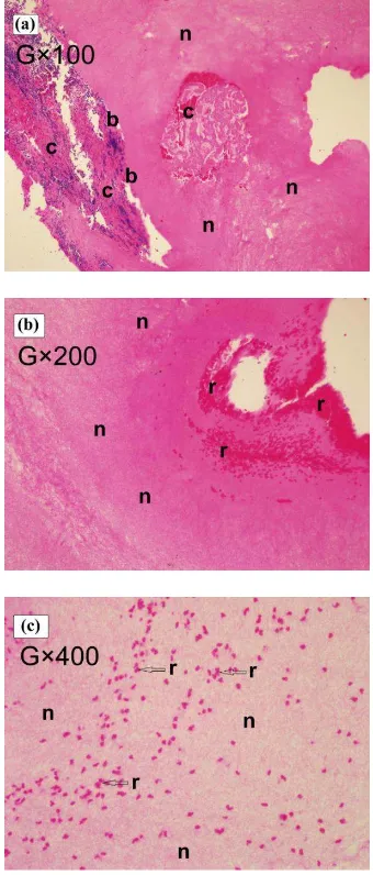 Fig. 1. The light microscopy analysis of the 2 min MT-PRF clot. Hematoxylin and eosin staining 