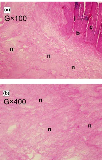 Fig. 4. The light microscopy analysis of the T-PRF clot. Hematoxylin and eosin staining (a) Mature fibrin network (light pink (n)) and cellular 