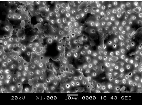 Fig. 2. SEM MICROGRAPHS SCORE 1 = Root canal surface covered with residue only at the  opening of the dentinal tubules  