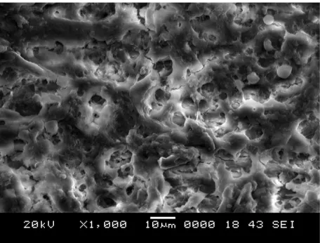 Fig. 4. SEM MICROGRAPHS SCORE 3 = Heavy smear layer. Smear layer covered the root canal  surface and the tubules  