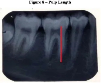 Figure 7-Tooth Length 