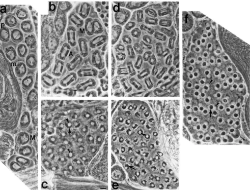 FIGURE 2.--Phase spermatocytes and cell, and are outlined by phase dense layers of membrane and mitochondria (m) aligned along the periphery distinguishable from one  another by the size and number of cells in cells mitochondria in each  cell have aggregat