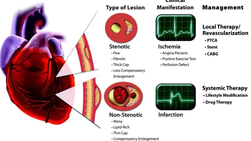 Figure 2.3-2  Two extreme examples of atherosclerosis in the human coronary artery and their 