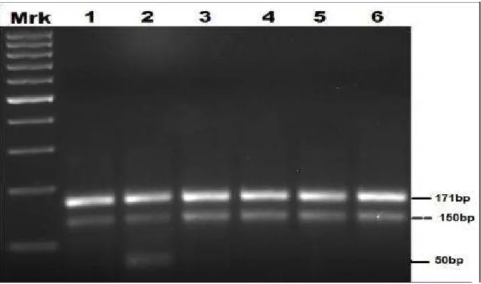 Fig. 2. RT PCR products of MTHFR gene polymorphism are separated on Agarose (3%) gel electrophoresis stained by ethedium bromide and allele specific amplicons are visualized & 