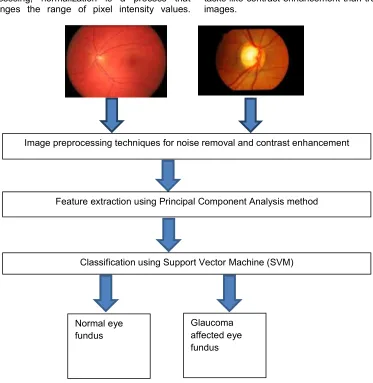 Fig. 1. Proposed design for detection of Glaucoma 