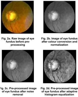 Fig. 2a. Raw image of eye 
