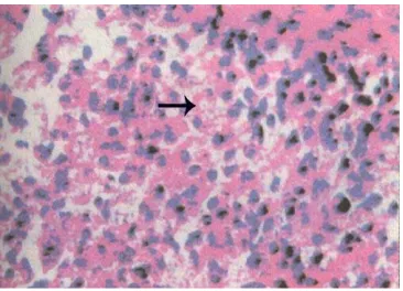 Fig. 3. Section of skin stained with Gomori  methanamine silver staining showing black 
