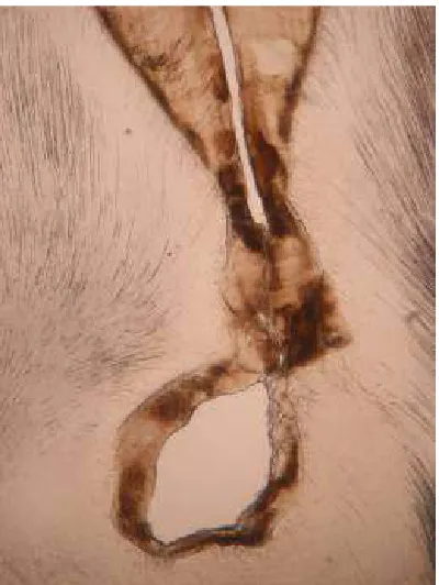 Fig. 5. Decalcified eosin stained specimen ‘C’  showing dentin and pulp like tissue 
