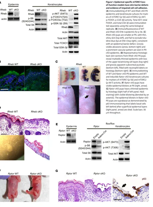 Figure 1. Epidermal-specific mTORC1 loss-of-function models have skin barrier defects 
