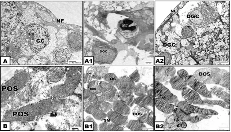 Fig. 4. Histological section of lens of offsprings. A. control lens showing normal arrangement 