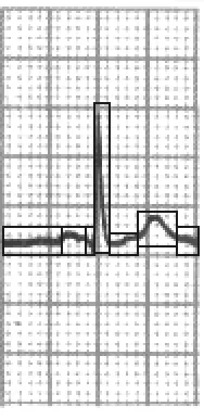 Figure 3 Approximation of a curve by 8-element polyline.