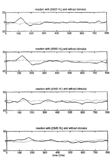 Figure I: averages of 100 sweeps each, with (solid) and without (dotted) given stimulus (sine-burst of 1kHz)
