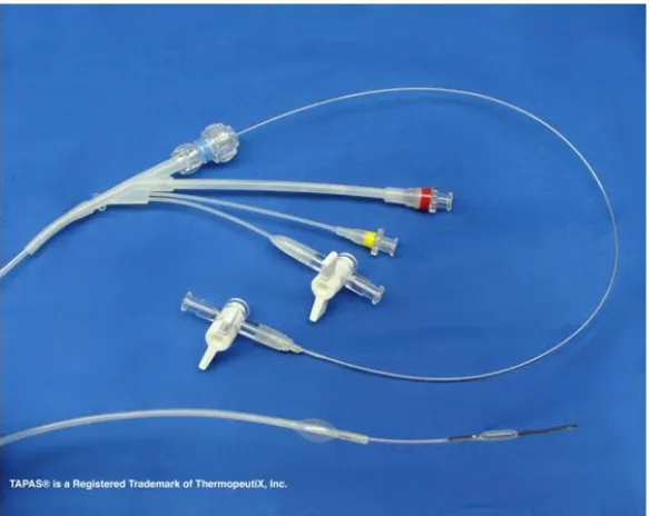 Fig. 5. Tapas isolated infusion catheter (Thermapeutix) 