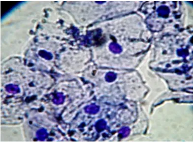 Fig. 1. Normal epithelial cells in cell lining   mouth of non-smokers, stained with  Giemsa stain, (400X) 