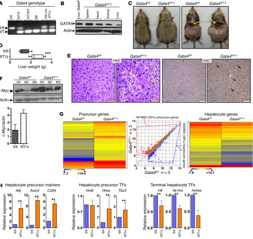 Figure 2. Liver-conditional Gata4Proliferation evaluated by immunohistochemistry for KI67