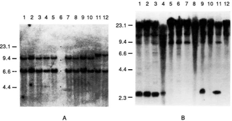FIGURE 3.-Southern blot analysis of fuull 4 . 9  and Lmes 62-s derivatives. (A) Bglll digests hybridized to the br-specific probe pAGS528  (DOONER et al
