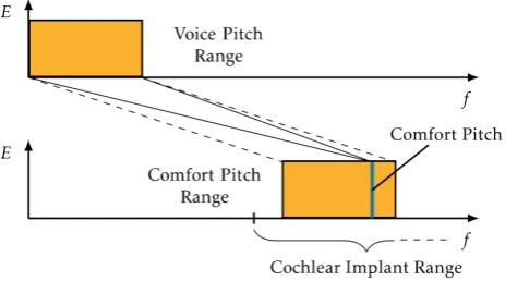 Figure 10. Difference of voice pitch range and comfort pitch spacial disjunct from the range, a cochlear implant can address
