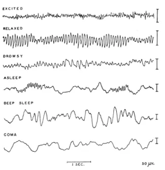 Figure 2.3: Characteristic EEG rhythms, depending on the state of consciousness.