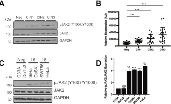 Figure 1. JAK2 is aberrantly phosphorylated in cervical disease and HPV+ cervical cancer cells