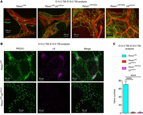 Figure 8. Blocked LV valve development in induced RASA1-deficient and induced Rasa1R780Q embryos