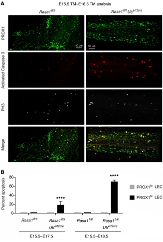 Figure 9. Apoptosis of PROX1hi LECs in developing LV valves of induced RASA1-deficient embryos