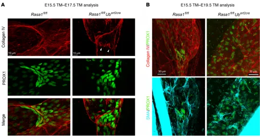 Figure 10. Discontinuous ECM in developing LV valve leaflets of induced RASA1-deficient embryos