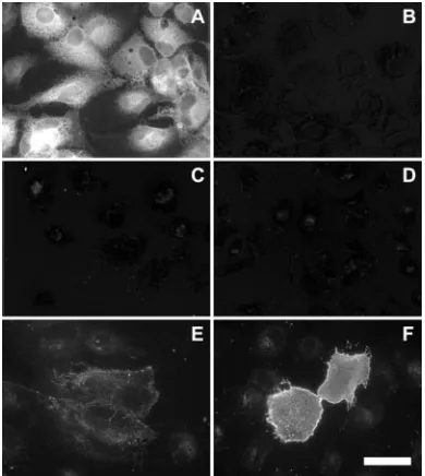 FIG. 3. Cell surface expression of HCV glycoprotein E2. Naive (Band D) or infected (A and C) Huh-7 cells grown on coverslips were