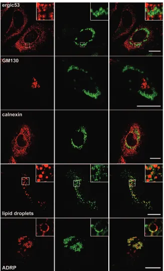 FIG. 4. Confocal immunoﬂuorescence analysis of the intracellular distribution of the capsid protein