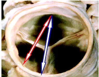 Fig. 6. The basal short-axis view shows the 