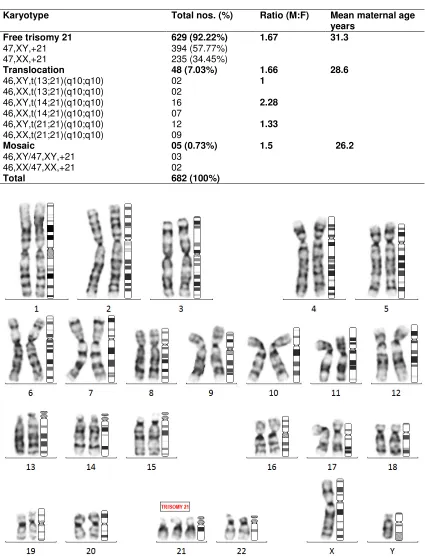 Table 1. Karyotype analysis of 682 Down syndrome case 