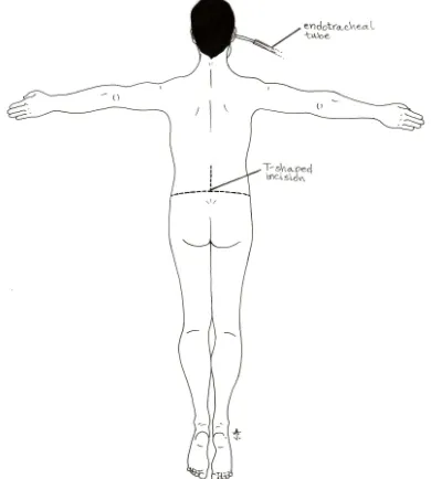 Fig. 2. The patient is initially prone during 