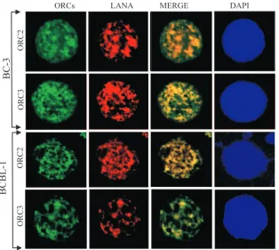 FIG. 5. Origin recognition complexes colocalize with LANA in PELs. Gacetone and ORCs were detected using speciﬁc antibodies after blocking with 20% BSA