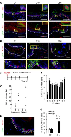 Figure 3. Basal Krt15in the esophageal epithelium. + cells give rise to all squamous lineages (A and B) Krt15-CrePR1 R26