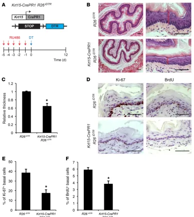Figure 6. Depletion of Krt152-tailed Student’s R26+ cells leads to reduced proliferation and epithelial atrophy
