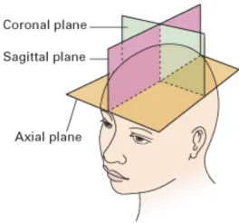 Figure 1.3: The three different axes Axial, Coronal, and Sagittal. Image Source:https://casemed.case.edu/clerkships/neurology/