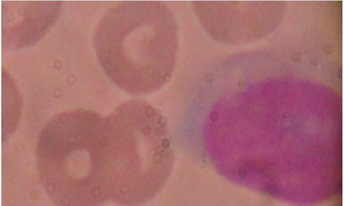 Fig. 3C. Photomicrograph of Thin blood film showing normal Lymphocyte and