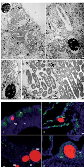 Fig. 2. (A–D) Size variability ofbacterial aggregates within coralgastrodermal tissue layers fromas small as 7 µm (A) to 80 µm(D) in length in Acropora asperaas identified using EUBmix, sim-ilar to that of Tabular Acroporaof the GBR (C)