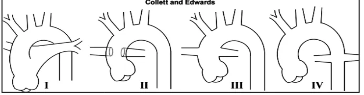 Fig. 12 A and B: coronal and sagittal reconstructed images for a patient withFig. 12 A and B: coronal and sagittal reconstructed images for a patient withsame patient that shows the aortopulmonary connection which is being measured byFig