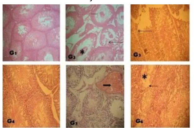 Fig. 4A. Amelioration of radiation-induced histological changes in testes of Wistar rats after 24