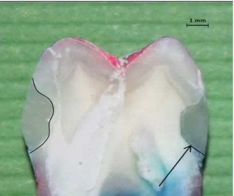 Fig. 2. An AutoCAD image displaying a longitudinal section of a premolar