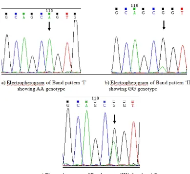 Fig. 4. Electropherograms indicating the transition of 542 A>G (S38G) in KCNE1 gene