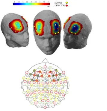 Figure 2. Locations of sources, detectors, and channels and underlying graphic representation of oxyhemoglobin concentration in the dorsolateralprefrontal cortex during a dental virtual reality task.